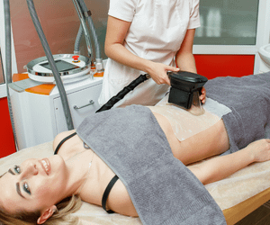 Womang getting a Coolsculpting treatment in abdomen
