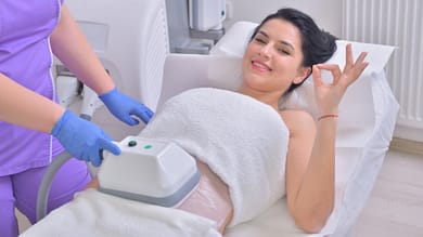 woman getting coolsclupting treatment