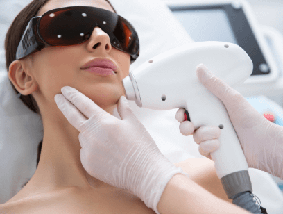 laser hair removal in the face